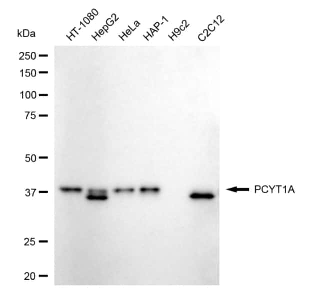 100UL PCYT1A RMAB 100 UL