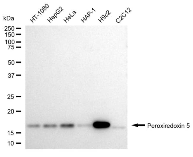 100UL PRDX5 RMAB 100 UL