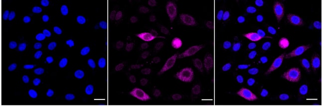 100UL PHOSPHO-CDC6 (SER106) RMAB 100 UL