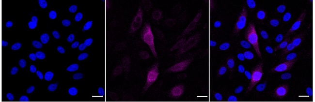 100UL PHOSPHO-CYCLIN B1 (SER126 RMAB 100