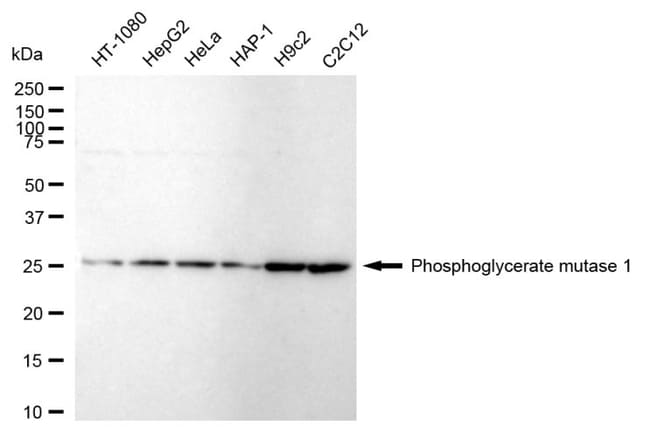 100UL PGAM1 RMAB 100 UL