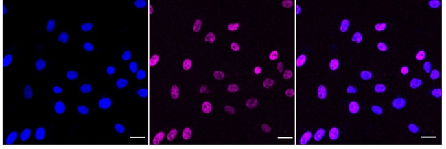 100UL PHOSPHO-HSF1 (SER303, SER RMAB 100
