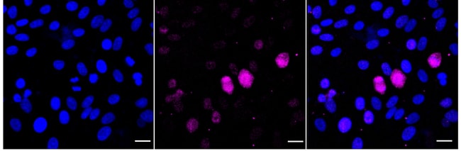 100UL PHOSPHO-HSF1 (SER326) RMAB 100 UL