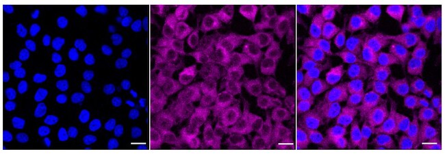 100UL PHOSPHO-MTOR (SER2448) RMAB 100 UL