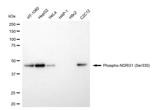 100UL PHOSPHO-NDRG1 (SER330) RMAB 100 UL