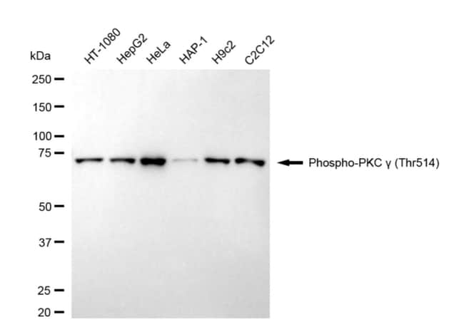 100UL PHOSPHO-PKC GAMMA (THR514 RMAB 100