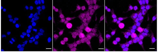 100UL PHOSPHO-PRESENILIN 1 (SER RMAB 100