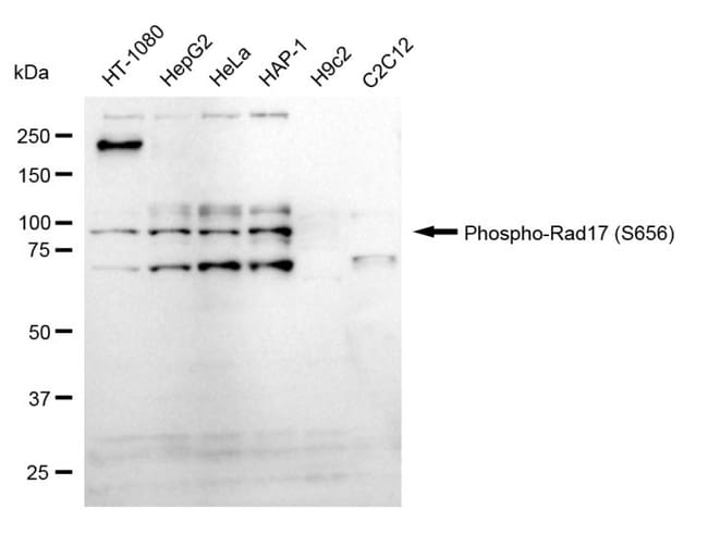 100UL PHOSPHO-RAD17 (SER656) RMAB 100 UL