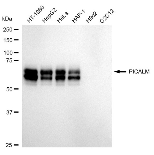 100UL CALM RMAB 100 UL