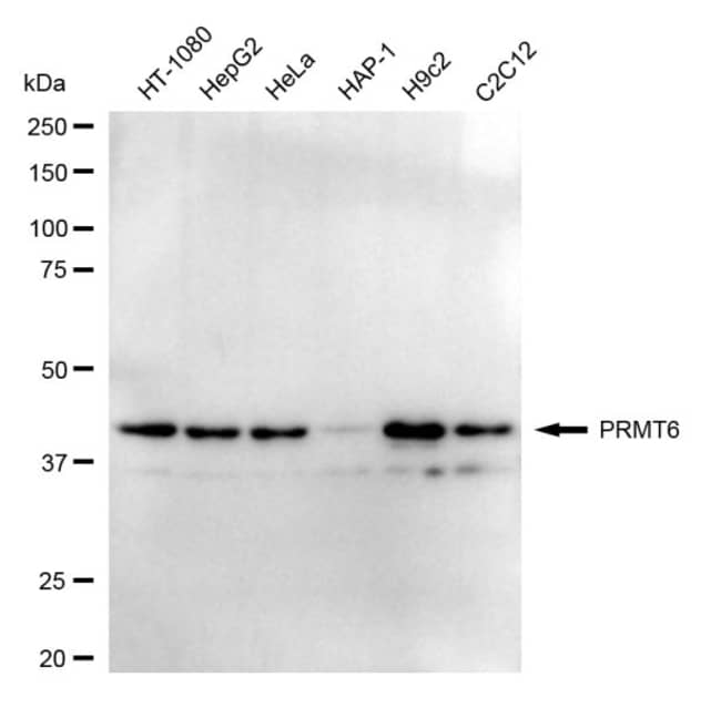 100UL PRMT6 RMAB 100 UL