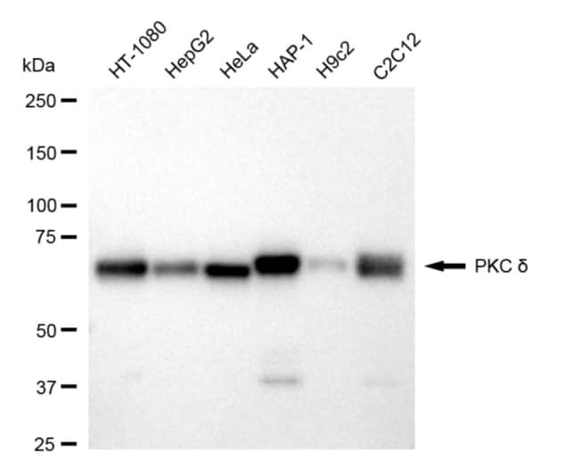 100UL PKC DELTA RMAB 100 UL