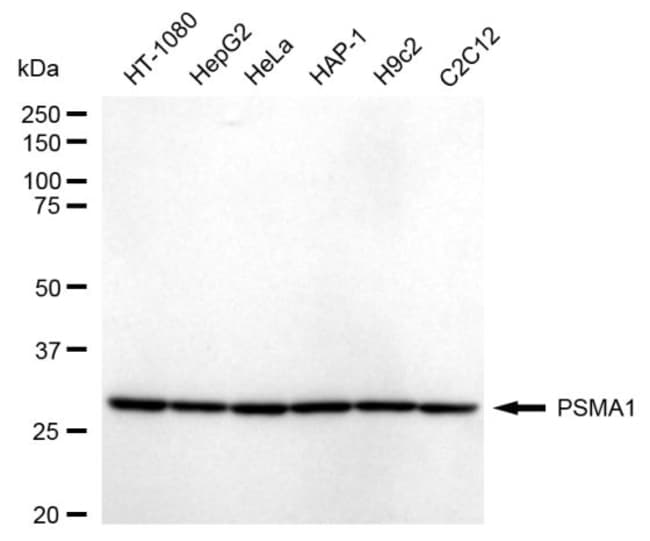 100UL PSMA1 RMAB 100 UL