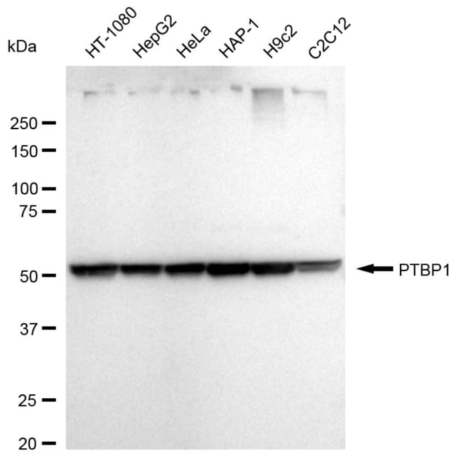 100UL PTBP1 RMAB 100 UL