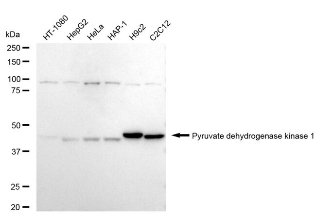 100UL PDK1 RMAB 100 UL