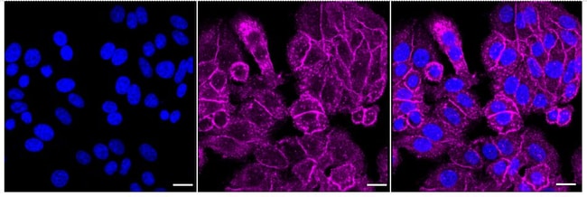 100UL RADIXIN RMAB 100 UL