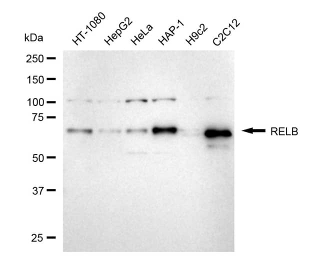 100UL RELB RMAB 100 UL