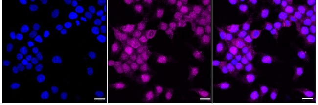 100UL RPS6KB2 RMAB 100 UL