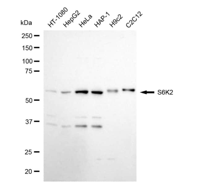 100UL RPS6KB2 RMAB 100 UL