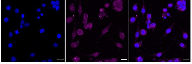 100UL SDHC RMAB 100 UL