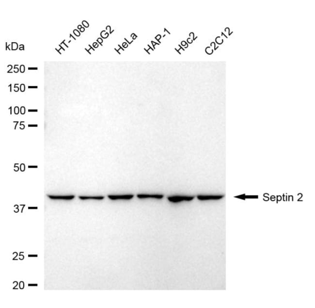 100UL SEPTIN 2 RMAB 100 UL