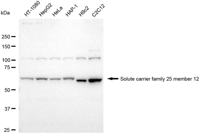 100UL SLC25A12 RMAB 100 UL