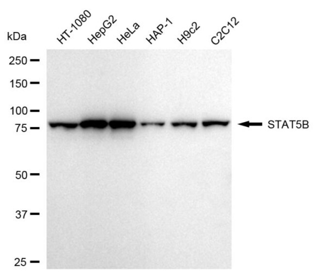 100UL STAT5 BETA RMAB 100 UL
