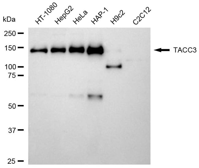 100UL TACC3 RMAB 100 UL