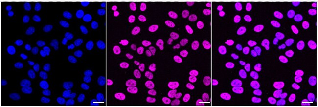 100UL TRBP RMAB 100 UL