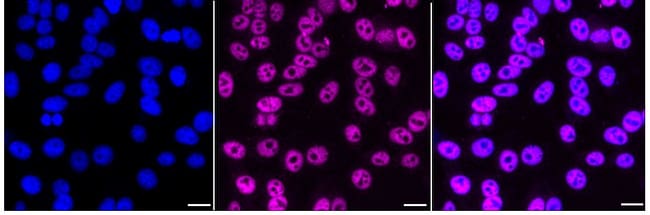100UL AP2 ALPHA RMAB 100 UL