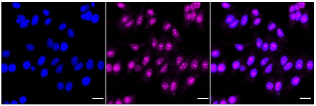 100UL NUCLEAR MATRIX PROTEIN P8 RMAB 100