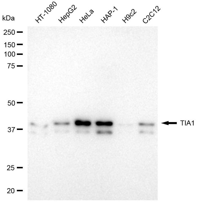 100UL TIA-1 RMAB 100 UL