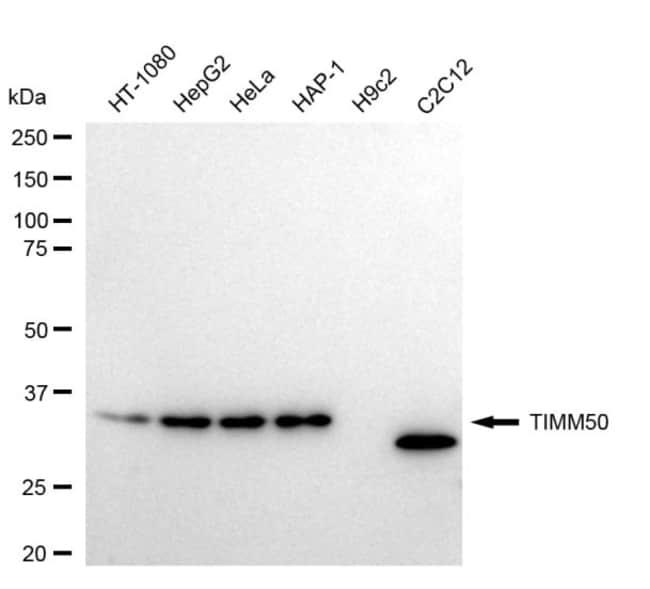 100UL TIMM50 RMAB 100 UL