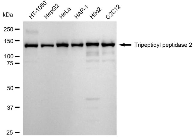 100UL TPP2 RMAB 100 UL