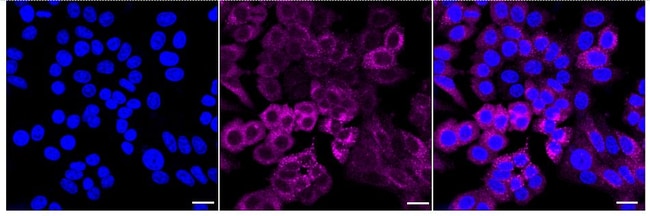 100UL TRK FUSED GENE RMAB 100 UL