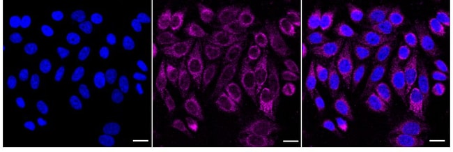 100UL UQCRC2 RMAB 100 UL