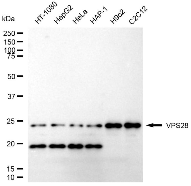 100UL VPS28 RMAB 100 UL