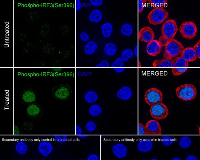 PHOSPHO-IRF3 (SER396) RMAB 100 UL