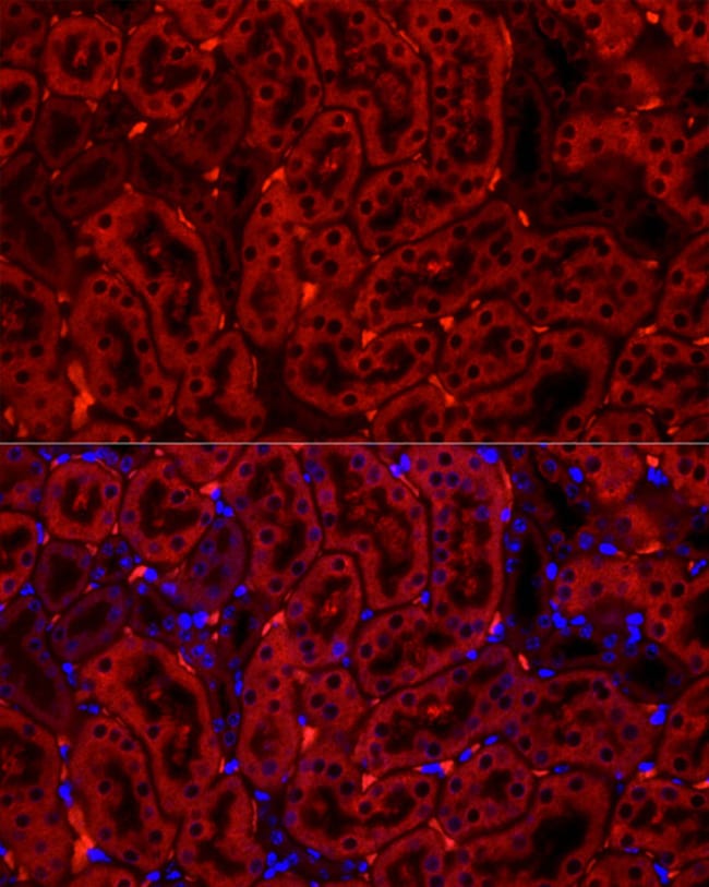 CYP2E1 RMAB 100 UL