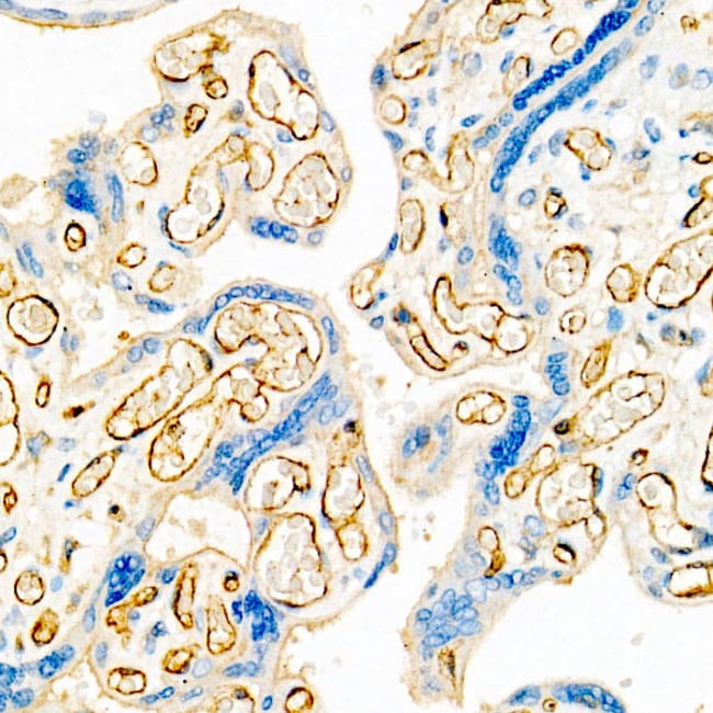 VE-CADHERIN RMAB 100 UL