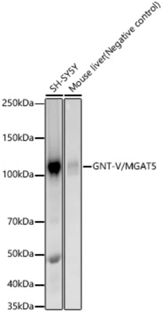MGAT5 RMAB 100 UL