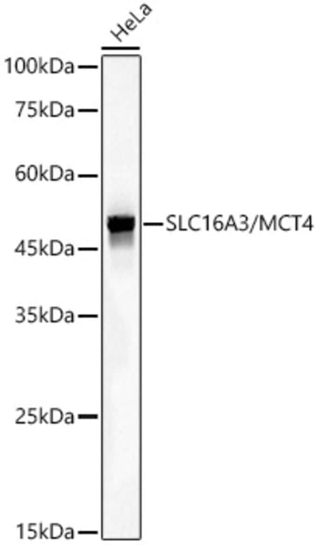 SLC16A3 RMAB 100 UL