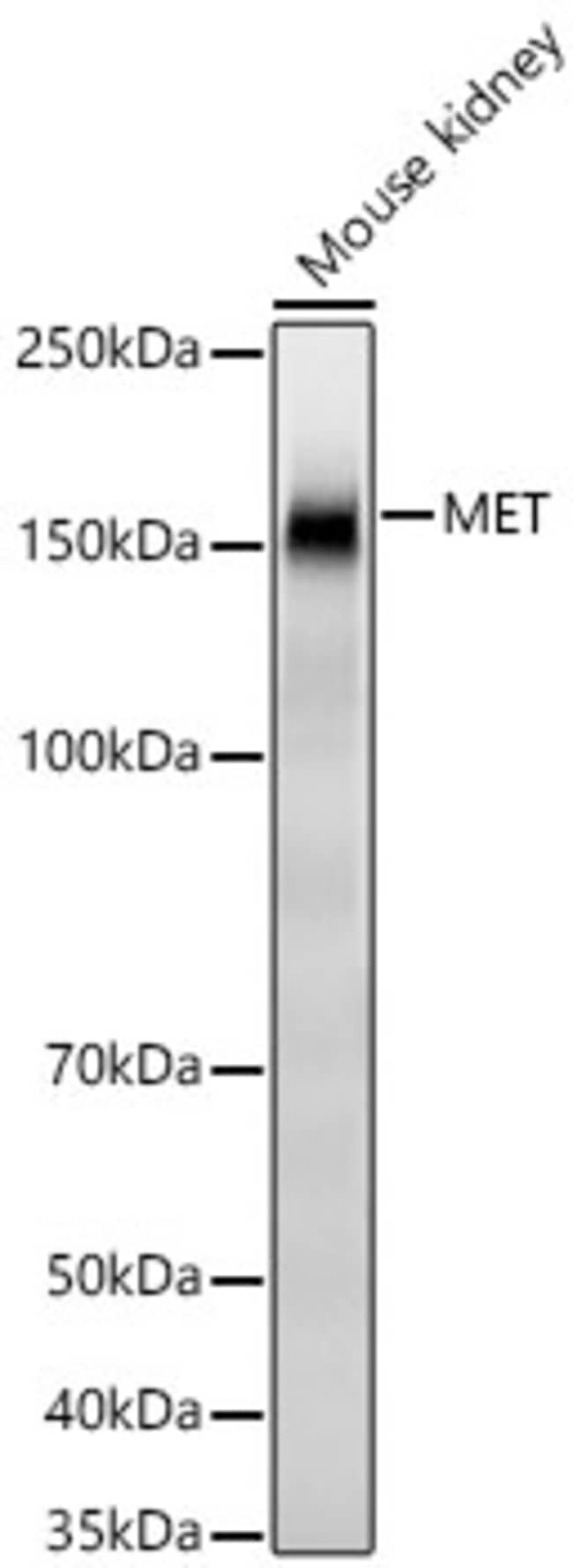 C-MET RMAB 100 UL