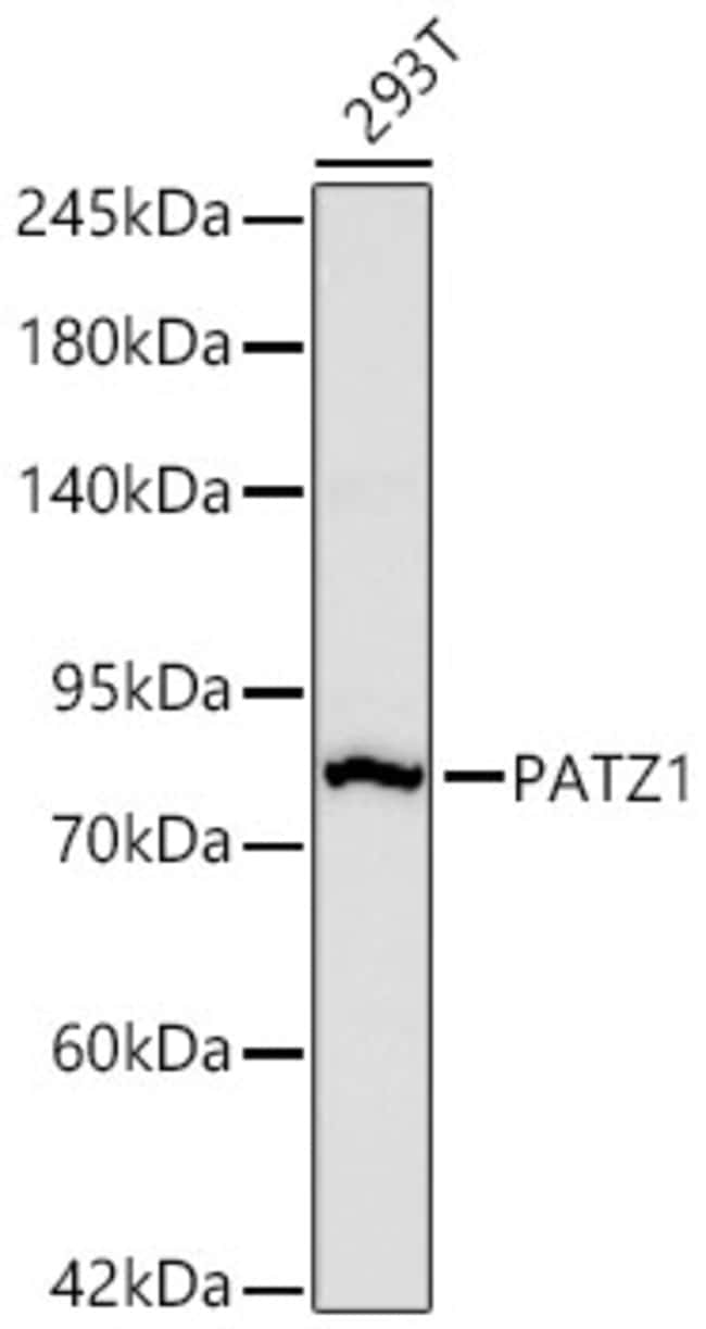 PATZ1 RMAB 100 UL