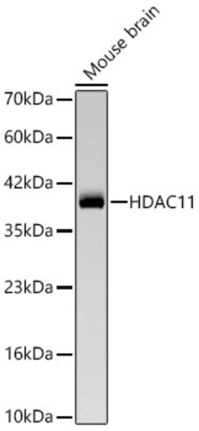 HDAC11 RMAB 100 UL