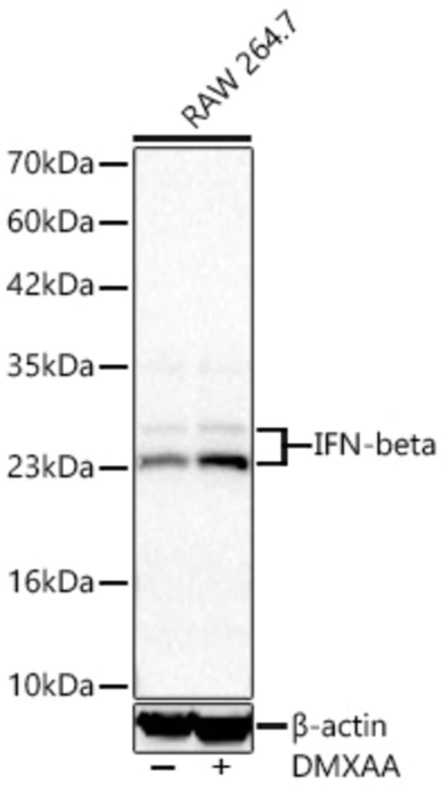 IFN BETA RMAB 100 UL