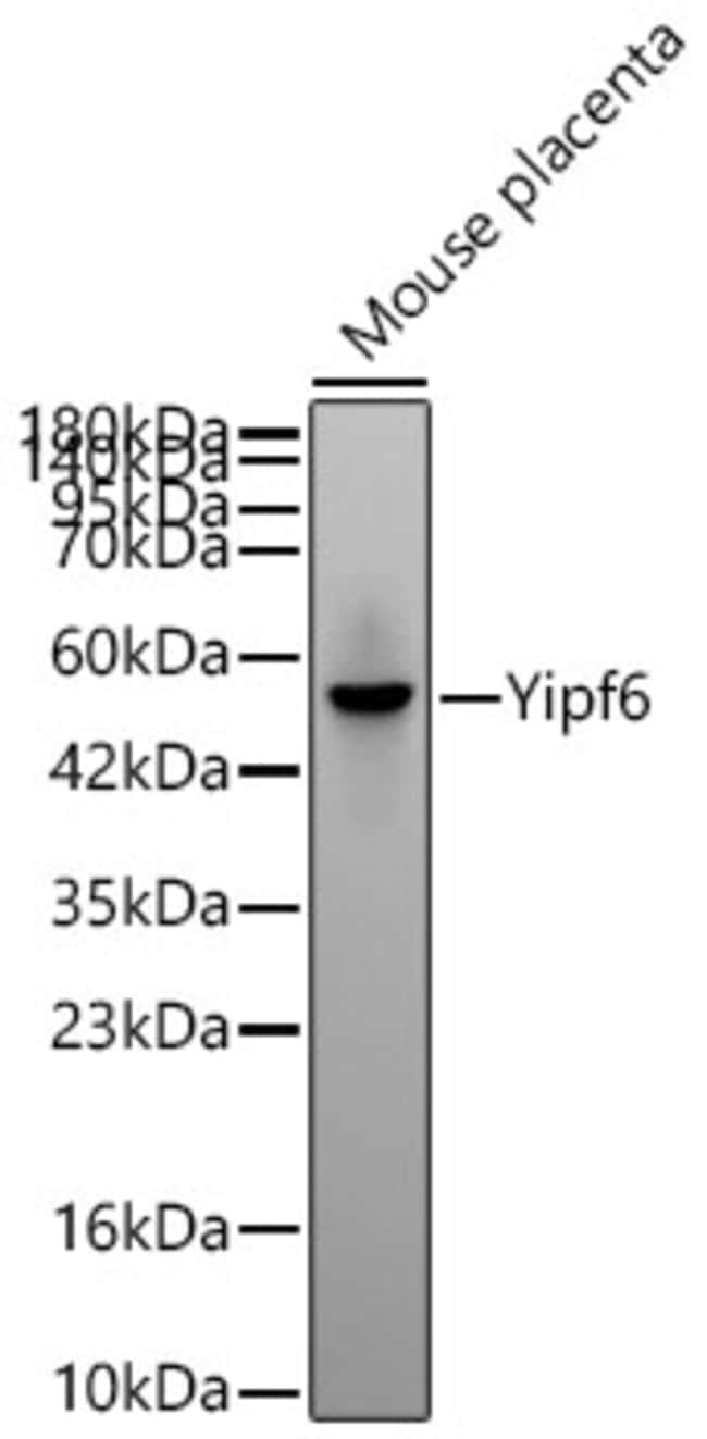 YIPF6 RMAB 100 UL