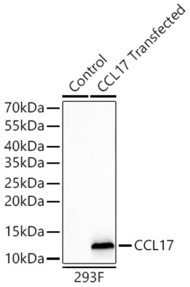 TARC RMAB 100 UL