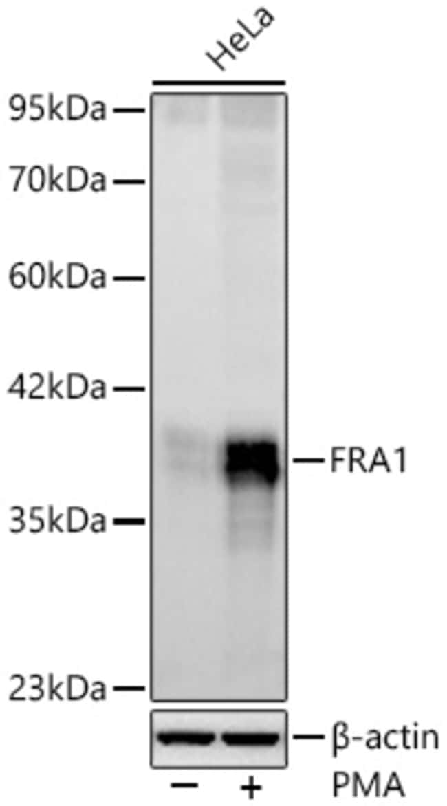 FRA1 RMAB 100 UL