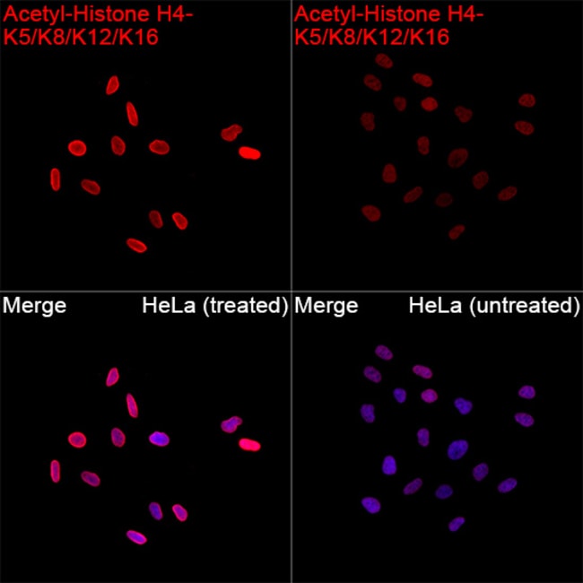 H4AC PAN-ACETYL (K5,K8,K1 RMAB 100 UL