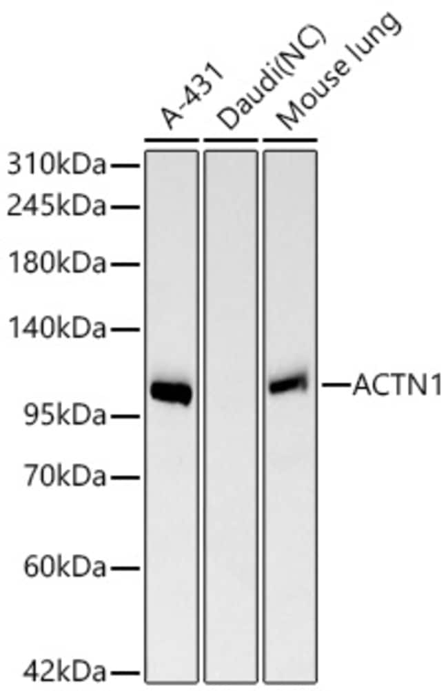 ALPHA ACTININ 1 RMAB 100 UL